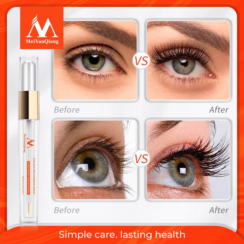 Eyelash Eyebrow Growth Serum/ 3-6 Days Delivery - LightsBetter