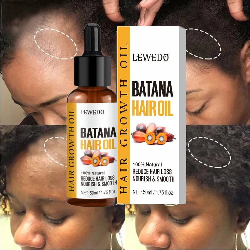 Organic Pure Batana Oil - LightsBetter